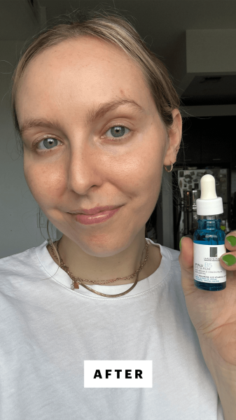Allure associate beauty director Sarah Kinonen after applying the La RochePosay Hyalu B5 Eye Serum