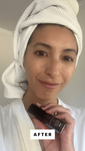 Pai after applying the SkinCeuticals AOX Eye Gel