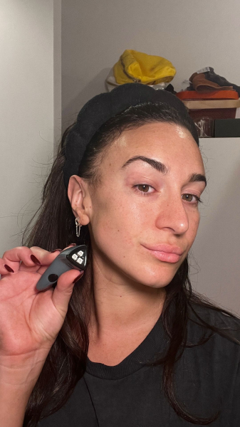 Wohlner after using the Solawave Bye Acne 3Minute Pimple Spot Treatment